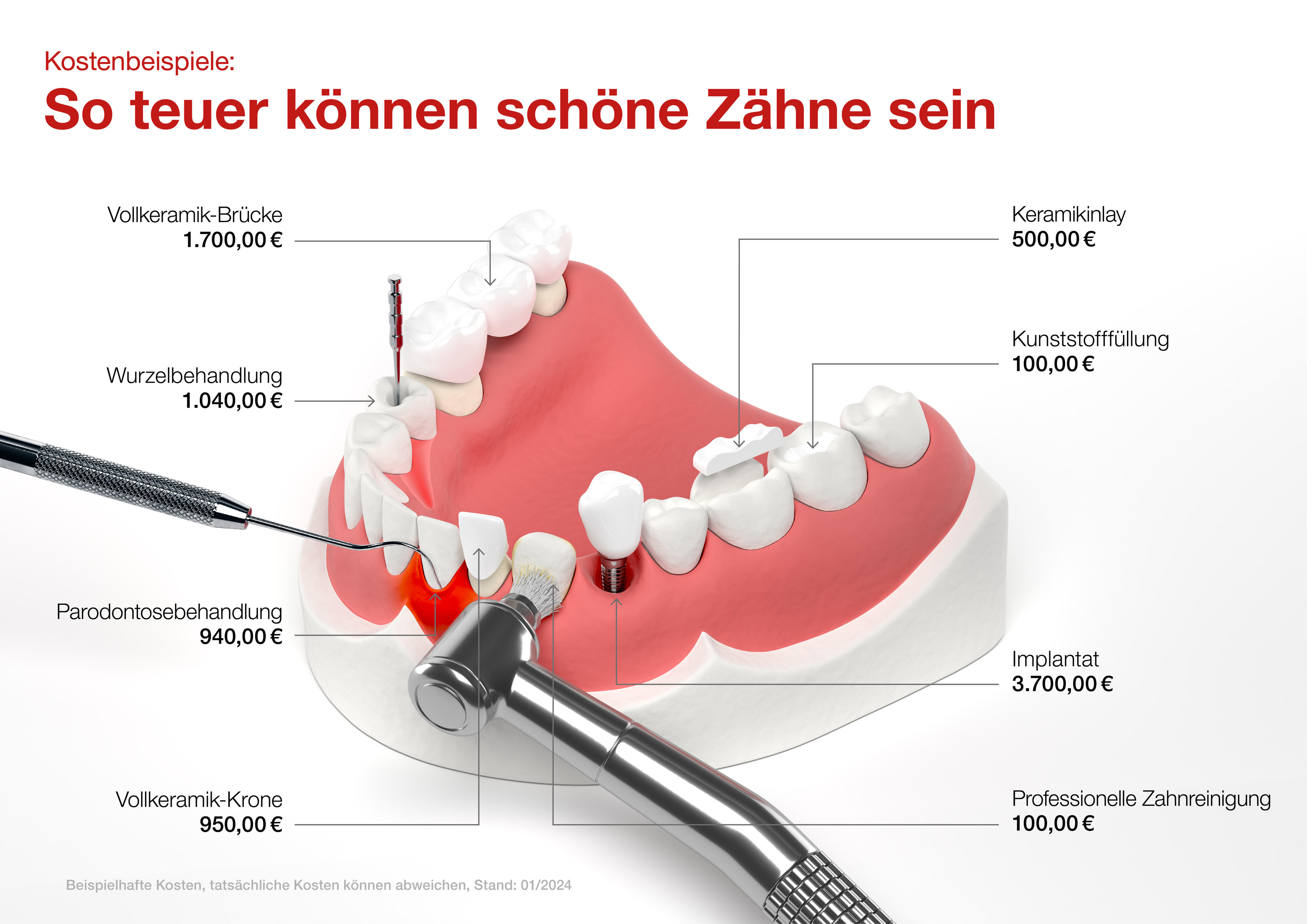 Übersichtsgrafik, die zeigt, was zahnrettende und -ersetzende Maßnahmen kosten